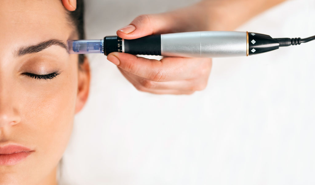 Mesotherapie Hautverjüngung